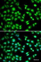 Immunofluorescence analysis of HeLa cells using CDKN2D Polyclonal Antibody