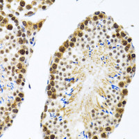 Immunohistochemistry of paraffin-embedded Rat testis using CIRBP Polyclonal Antibody at dilution of 1:100 (40x lens) .