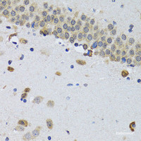 Immunohistochemistry of paraffin-embedded Mouse brain using CIRBP Polyclonal Antibody at dilution of 1:100 (40x lens) .