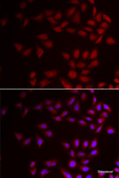 Immunofluorescence analysis of HeLa cells using CIRBP Polyclonal Antibody