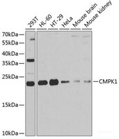 Western blot analysis of extracts of various cell lines using CMPK1 Polyclonal Antibody at dilution of 1:1000.