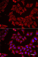 Immunofluorescence analysis of MCF7 cells using CMPK1 Polyclonal Antibody