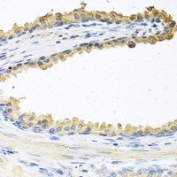 Immunohistochemistry of paraffin-embedded Human prostate using COCH Polyclonal Antibody at dilution of 1:100 (40x lens) .