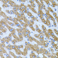Immunohistochemistry of paraffin-embedded Human liver damage using CPM Polyclonal Antibody at dilution of 1:100 (40x lens) .