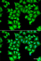 Immunofluorescence analysis of HeLa cells using CPSF3L Polyclonal Antibody