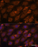 Immunofluorescence analysis of C6 cells using CREB3 Polyclonal Antibody at dilution of 1:100. Blue: DAPI for nuclear staining.