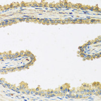 Immunohistochemistry of paraffin-embedded Human prostate using CRHBP Polyclonal Antibody at dilution of 1:100 (40x lens) .