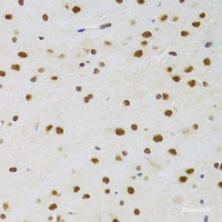 Immunohistochemistry of paraffin-embedded Rat brain using CSRP3 Polyclonal Antibody at dilution of 1:100 (40x lens) .