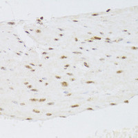 Immunohistochemistry of paraffin-embedded Human stomach using CSRP3 Polyclonal Antibody at dilution of 1:100 (40x lens) .