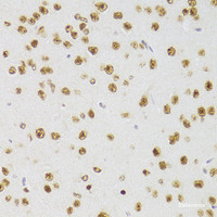 Immunohistochemistry of paraffin-embedded Mouse brain using CSRP3 Polyclonal Antibody at dilution of 1:100 (40x lens) .