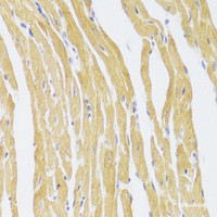 Immunohistochemistry of paraffin-embedded Mouse heart using CSRP3 Polyclonal Antibody at dilution of 1:100 (40x lens) .