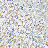 Immunohistochemistry of paraffin-embedded Mouse stomach using CST1 Polyclonal Antibody at dilution of 1:100 (40x lens) .