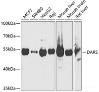 Western blot analysis of extracts of various cell lines using DARS Polyclonal Antibody at dilution of 1:1000.
