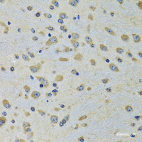 Immunohistochemistry of paraffin-embedded Rat brain using DARS Polyclonal Antibody at dilution of 1:100 (40x lens) .