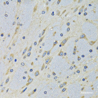Immunohistochemistry of paraffin-embedded Mouse brain using DARS Polyclonal Antibody at dilution of 1:100 (40x lens) .