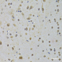 Immunohistochemistry of paraffin-embedded Rat brain using DDX1 Polyclonal Antibody at dilution of 1:100 (40x lens) .