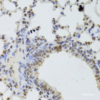 Immunohistochemistry of paraffin-embedded Mouse lung using DDX1 Polyclonal Antibody at dilution of 1:100 (40x lens) .