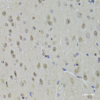 Immunohistochemistry of paraffin-embedded Mouse brain using DDX1 Polyclonal Antibody at dilution of 1:100 (40x lens) .