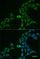 Immunofluorescence analysis of MCF7 cells using DDX1 Polyclonal Antibody