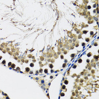 Immunohistochemistry of paraffin-embedded Rat testis using DDX41 Polyclonal Antibody at dilution of 1:100 (40x lens) .