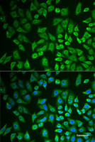 Immunofluorescence analysis of U2OS cells using DDX41 Polyclonal Antibody