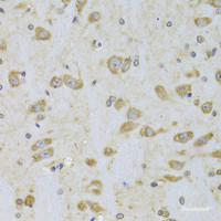 Immunohistochemistry of paraffin-embedded Rat brain using EEF1B2 Polyclonal Antibody at dilution of 1:100 (40x lens) .