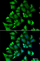 Immunofluorescence analysis of A549 cells using ENTPD2 Polyclonal Antibody