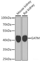 Western blot analysis of extracts of various cell lines using GATM Polyclonal Antibody at dilution of 1:1000.