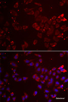 Immunofluorescence analysis of A549 cells using GATM Polyclonal Antibody