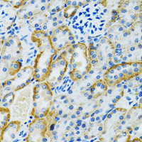 Immunohistochemistry of paraffin-embedded Rat kidney using GDAP1 Polyclonal Antibody at dilution of 1:100 (40x lens) .