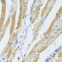 Immunohistochemistry of paraffin-embedded Rat heart using GDAP1 Polyclonal Antibody at dilution of 1:100 (40x lens) .