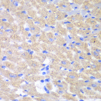 Immunohistochemistry of paraffin-embedded Mouse heart using GPAM Polyclonal Antibody at dilution of 1:100 (40x lens) .