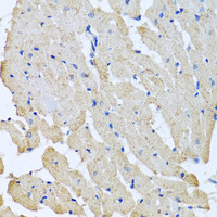 Immunohistochemistry of paraffin-embedded Rat heart using GPLD1 Polyclonal Antibody at dilution of 1:100 (40x lens) .