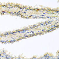 Immunohistochemistry of paraffin-embedded Human prostate using GPLD1 Polyclonal Antibody at dilution of 1:100 (40x lens) .