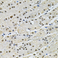 Immunohistochemistry of paraffin-embedded Human stomach using Histone H2A.Z Polyclonal Antibody at dilution of 1:100 (40x lens) .