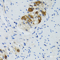 Immunohistochemistry of paraffin-embedded Human colon using HYOU1 Polyclonal Antibody at dilution of 1:100 (40x lens) .