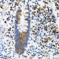 Immunohistochemistry of paraffin-embedded Human vermiform appendix using HYOU1 Polyclonal Antibody at dilution of 1:100 (40x lens) .
