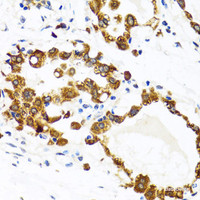 Immunohistochemistry of paraffin-embedded Human breast using HYOU1 Polyclonal Antibody at dilution of 1:100 (40x lens) .