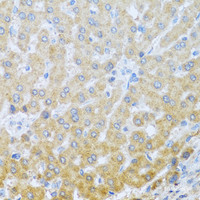 Immunohistochemistry of paraffin-embedded Human liver using IL20 Polyclonal Antibody at dilution of 1:100 (40x lens) .