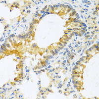 Immunohistochemistry of paraffin-embedded Mouse lung using IL20 Polyclonal Antibody at dilution of 1:100 (40x lens) .