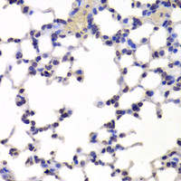 Immunohistochemistry of paraffin-embedded Mouse lung using INTS6 Polyclonal Antibody at dilution of 1:100 (40x lens) .