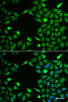 Immunofluorescence analysis of A549 cells using INTS6 Polyclonal Antibody