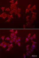 Immunofluorescence analysis of A549 cells using LECT1 Polyclonal Antibody