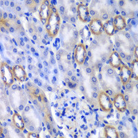 Immunohistochemistry of paraffin-embedded Mouse kidney using MATK Polyclonal Antibody at dilution of 1:100 (40x lens) .