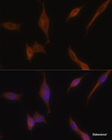 Immunofluorescence analysis of NIH-3T3 cells using MLPH Polyclonal Antibody at dilution of 1:100. Blue: DAPI for nuclear staining.