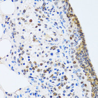 Immunohistochemistry of paraffin-embedded Rat lung using MTA3 Polyclonal Antibody at dilution of 1:100 (40x lens) .
