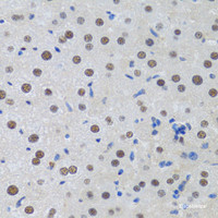 Immunohistochemistry of paraffin-embedded Rat liver using MTA3 Polyclonal Antibody at dilution of 1:100 (40x lens) .