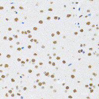 Immunohistochemistry of paraffin-embedded Rat brain using MTA3 Polyclonal Antibody at dilution of 1:100 (40x lens) .