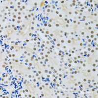 Immunohistochemistry of paraffin-embedded Rat kidney using MTA3 Polyclonal Antibody at dilution of 1:100 (40x lens) .