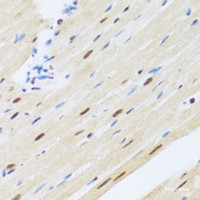Immunohistochemistry of paraffin-embedded Rat heart using MTA3 Polyclonal Antibody at dilution of 1:100 (40x lens) .